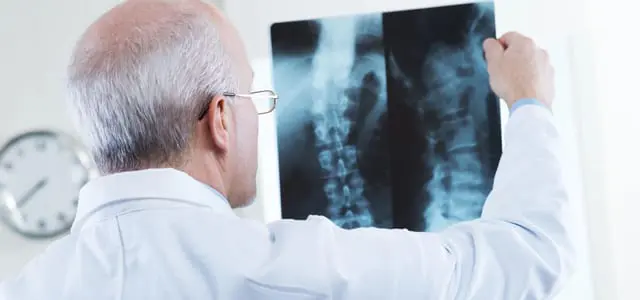 A man looking at an x-ray of his back.