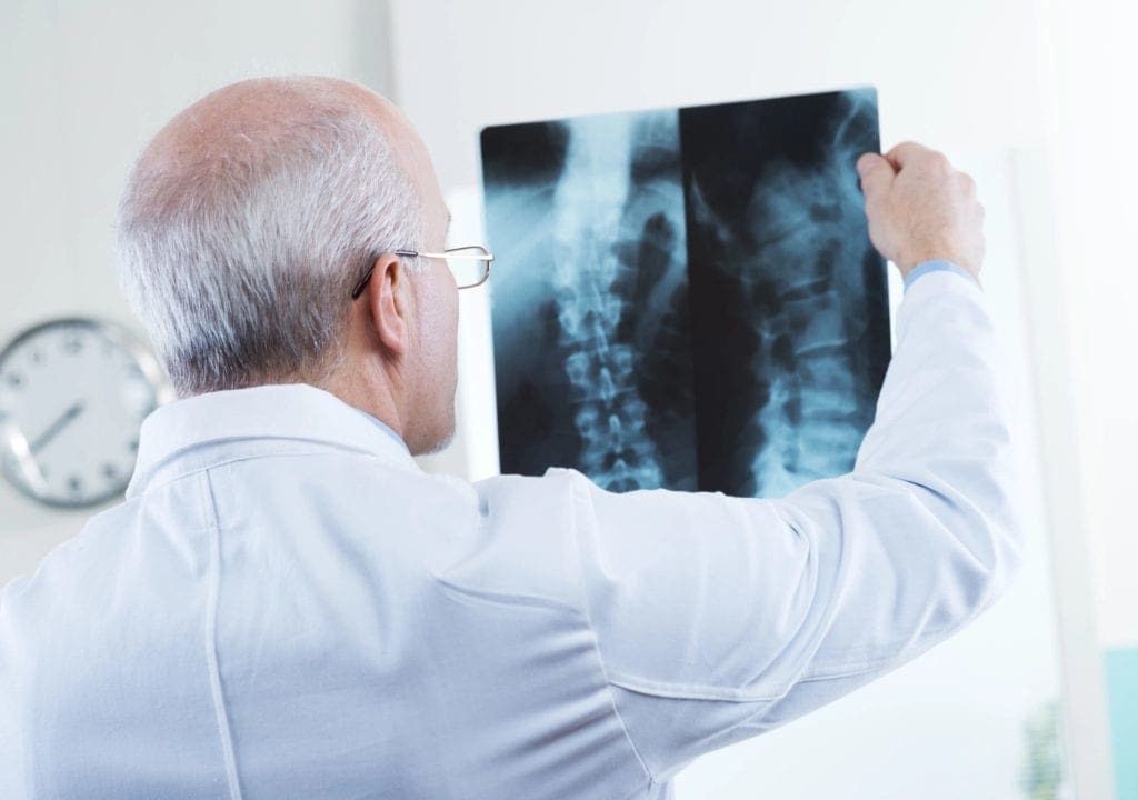 A man holding up an x-ray of his back.