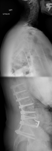 A black and white photo of an x-ray